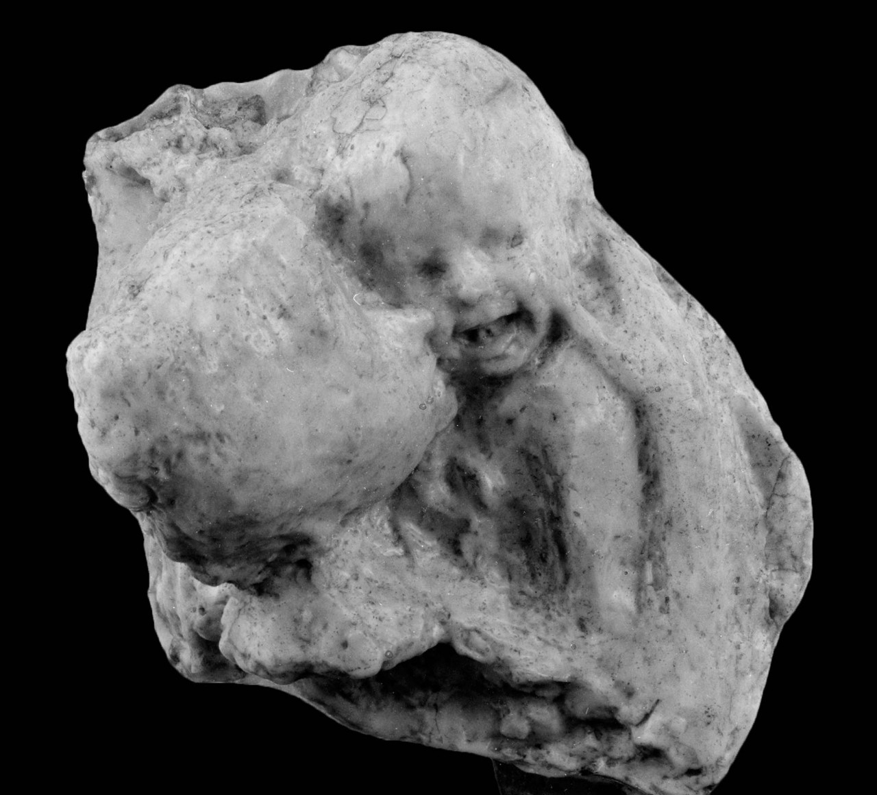 Aetas Aurea di Medardo Rosso